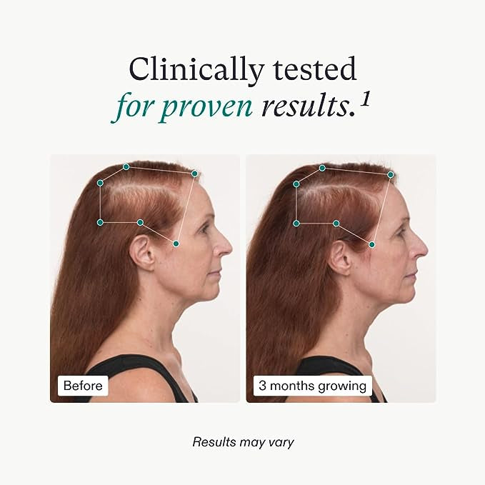 Suplemento para el Crecimiento del Cabello Femenino – Cápsulas Avanzadas para el Cuidado del Cabello