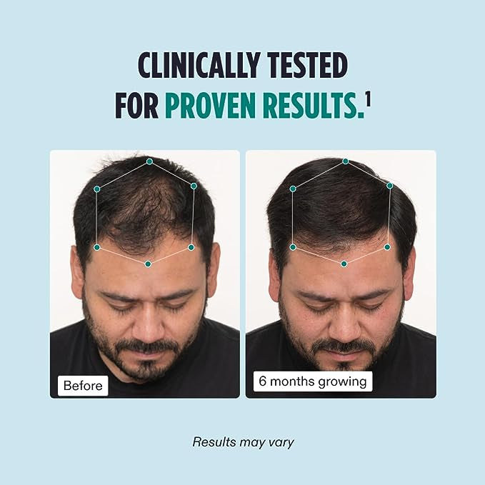 Men's Hair Growth Support Supplement – Advanced Hair Wellness Formula