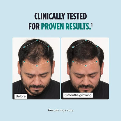 Men's Hair Growth Support Supplement – Advanced Hair Wellness Formula