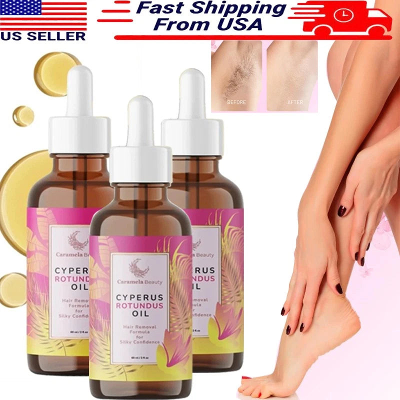 5PCS Cyperus Rotundus Oil - 60ml Natural Cyperus Rotundus Oil For Hair Removal